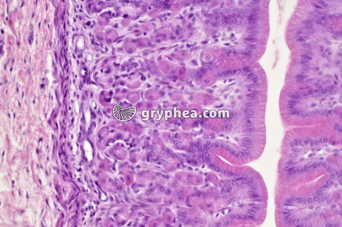 Estomac pylorique x100 - gryphea.org